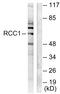 RCC1 And BTB Domain Containing Protein 1 antibody, A11528, Boster Biological Technology, Western Blot image 