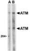 ATM Serine/Threonine Kinase antibody, A00014, Boster Biological Technology, Western Blot image 