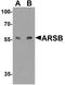 Arylsulfatase B antibody, TA326649, Origene, Western Blot image 