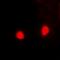 Proteasome 26S Subunit, Non-ATPase 10 antibody, abx141649, Abbexa, Western Blot image 