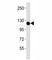 Colony Stimulating Factor 1 Receptor antibody, F53226-0.4ML, NSJ Bioreagents, Western Blot image 