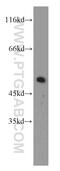 Dynactin Subunit 2 antibody, 10030-2-AP, Proteintech Group, Western Blot image 