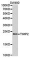 TIMP Metallopeptidase Inhibitor 2 antibody, A1558, ABclonal Technology, Western Blot image 