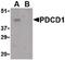 Programmed Cell Death 1 antibody, PA5-20351, Invitrogen Antibodies, Western Blot image 