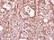 THO Complex 1 antibody, NBP2-16822, Novus Biologicals, Immunohistochemistry paraffin image 