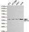 Histone methyltransferase SMYD2 antibody, M04281, Boster Biological Technology, Western Blot image 