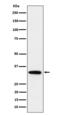 Serine/threonine-protein phosphatase 6 catalytic subunit antibody, M05295, Boster Biological Technology, Western Blot image 