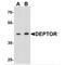 DEP Domain Containing MTOR Interacting Protein antibody, MBS153459, MyBioSource, Western Blot image 