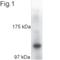 Kinesin Family Member 5A antibody, NB120-5628, Novus Biologicals, Western Blot image 