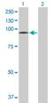 Vacuolar protein sorting-associated protein 16 homolog antibody, H00064601-B01P, Novus Biologicals, Western Blot image 