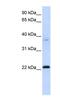 Chromosome 11 Open Reading Frame 74 antibody, NBP1-56712, Novus Biologicals, Western Blot image 