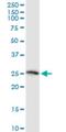 Twisted Gastrulation BMP Signaling Modulator 1 antibody, H00057045-M07, Novus Biologicals, Western Blot image 