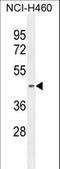 Pyruvate Dehydrogenase E1 Alpha 2 Subunit antibody, LS-C163479, Lifespan Biosciences, Western Blot image 