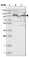 Mitogen-Activated Protein Kinase Kinase Kinase Kinase 5 antibody, PA5-57775, Invitrogen Antibodies, Western Blot image 