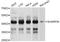 SHANK Associated RH Domain Interactor antibody, LS-C747094, Lifespan Biosciences, Western Blot image 