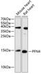 Profilin Family Member 4 antibody, 15-153, ProSci, Western Blot image 
