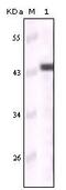 Keratin 5 antibody, MA5-15347, Invitrogen Antibodies, Western Blot image 