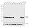 Ubiquitin C-Terminal Hydrolase L1 antibody, PA1-20158, Invitrogen Antibodies, Western Blot image 