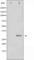Snail Family Transcriptional Repressor 1 antibody, abx012239, Abbexa, Western Blot image 