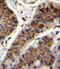 Inhibin Subunit Beta A antibody, LS-C165241, Lifespan Biosciences, Immunohistochemistry paraffin image 
