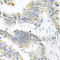 Snail Family Transcriptional Repressor 1 antibody, A5544, ABclonal Technology, Immunohistochemistry paraffin image 