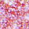 Erb-B2 Receptor Tyrosine Kinase 3 antibody, LS-C368595, Lifespan Biosciences, Immunohistochemistry paraffin image 