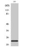 Sodium channel subunit beta-2 antibody, A06842-1, Boster Biological Technology, Western Blot image 