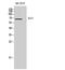 Pre-mRNA-splicing factor SLU7 antibody, STJ95687, St John