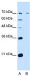 Polypeptide N-Acetylgalactosaminyltransferase 6 antibody, TA341885, Origene, Western Blot image 