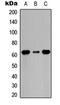 MutS Homolog 2 antibody, orb129696, Biorbyt, Western Blot image 