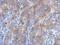 Inhibitor Of Nuclear Factor Kappa B Kinase Subunit Beta antibody, PA5-21683, Invitrogen Antibodies, Immunohistochemistry paraffin image 