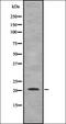 TNF Alpha Induced Protein 8 Like 1 antibody, orb337647, Biorbyt, Western Blot image 