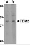 RASD Family Member 2 antibody, 4361, ProSci, Western Blot image 