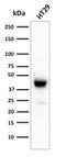 Keratin 20 antibody, GTX02660, GeneTex, Western Blot image 