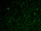 RAD51 Paralog C antibody, LS-C747585, Lifespan Biosciences, Immunofluorescence image 