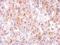 Glutathione S-Transferase Mu 1 antibody, NBP1-30876, Novus Biologicals, Immunohistochemistry paraffin image 