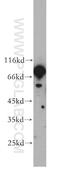Regulator Of G Protein Signaling 9 antibody, 17970-1-AP, Proteintech Group, Western Blot image 