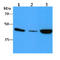 Actin Alpha 2, Smooth Muscle antibody, GTX57619, GeneTex, Western Blot image 