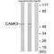 CaM Kinase Like Vesicle Associated antibody, A08356, Boster Biological Technology, Western Blot image 