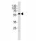 PHD Finger Protein 1 antibody, F52578-0.4ML, NSJ Bioreagents, Western Blot image 