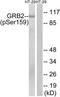 Growth factor receptor-bound protein 2 antibody, TA326160, Origene, Western Blot image 