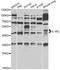 Interleukin 1 Receptor Type 2 antibody, LS-C749085, Lifespan Biosciences, Western Blot image 