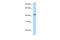 F-Box And Leucine Rich Repeat Protein 8 antibody, A17702, Boster Biological Technology, Western Blot image 