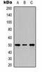 Tubulin Beta 2A Class IIa antibody, orb323223, Biorbyt, Western Blot image 