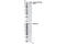 ERBB2 antibody, 2241S, Cell Signaling Technology, Western Blot image 