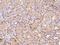 Protein Phosphatase, Mg2+/Mn2+ Dependent 1A antibody, 200367-T08, Sino Biological, Immunohistochemistry paraffin image 