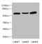 Macrophage Receptor With Collagenous Structure antibody, LS-C676024, Lifespan Biosciences, Western Blot image 