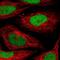 SET Nuclear Proto-Oncogene antibody, NBP2-38031, Novus Biologicals, Immunofluorescence image 