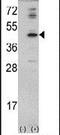 Mevalonate Diphosphate Decarboxylase antibody, PA5-13676, Invitrogen Antibodies, Western Blot image 