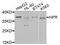 Haptoglobin-related protein antibody, STJ111940, St John